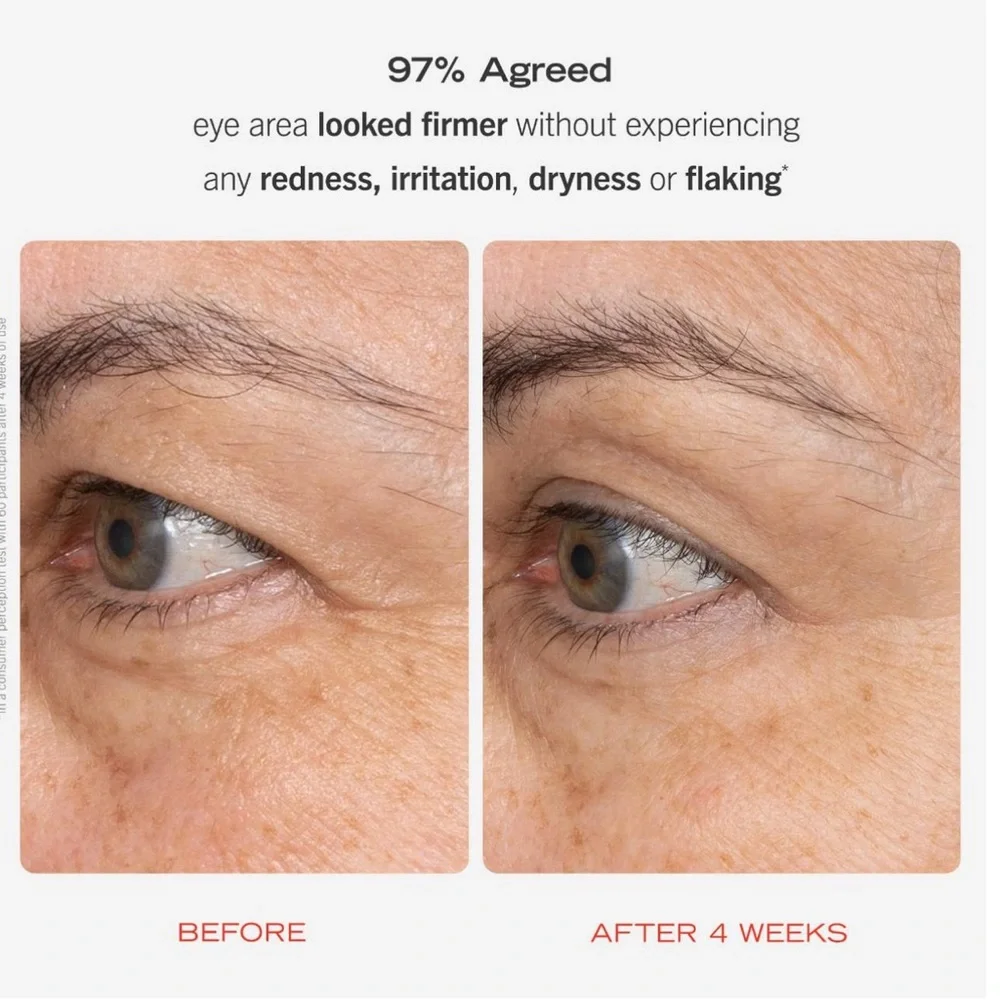 First Aid Beauty Retinol Eye Cream with Squalane & Ceramides 15 ml - Picture 2 of 5